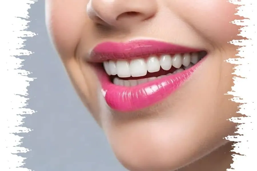 implantologia dentale