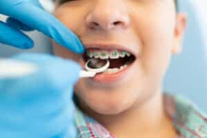 polizza sanitaria per problemi dentali